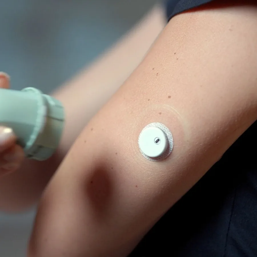 Linx CGM sensor worn on the upper arm, with the applicator